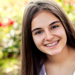 braces-girl braces-girl
